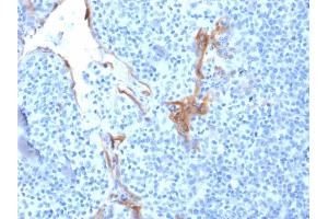 Formalin-fixed, paraffin-embedded human Tonsil stained with Cytokeratin 16 Mouse Monoclonal Antibody (LL025). (KRT16 antibody  (C-Term))