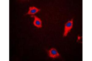 Immunofluorescent analysis of Beta-synuclein staining in HeLa cells. (beta Synuclein antibody  (C-Term))