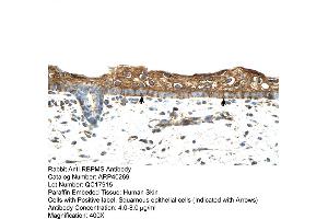 Rabbit Anti-RBPMS Antibody  Paraffin Embedded Tissue: Human Skin Cellular Data: Squamous epithelial cells Antibody Concentration: 4. (RBPMS antibody  (N-Term))