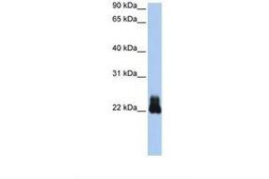 Image no. 1 for anti-Ras Homolog Family Member D (RHOD) (N-Term) antibody (ABIN6738031) (RHOD antibody  (N-Term))