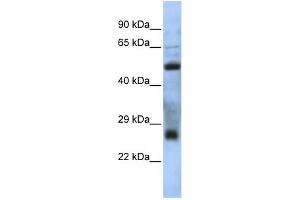 WB Suggested Anti-MGC26647 Antibody Titration: 0. (MGC26647 (N-Term) antibody)