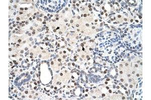 PSME3 antibody was used for immunohistochemistry at a concentration of 4-8 ug/ml to stain Epithelial cells of renal tubule (arrows) in Human Kidney. (PSME3 antibody  (N-Term))