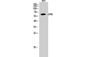 Western Blot (WB) analysis of 453 cells using OPN Polyclonal Antibody. (Osteopontin antibody  (C-Term))