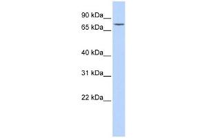 GALC antibody used at 1 ug/ml to detect target protein.