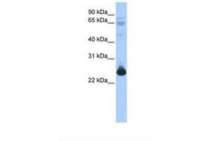 Image no. 1 for anti-Transcription Elongation Factor A (SII)-Like 1 (TCEAL1) (C-Term) antibody (ABIN6737839) (TCEAL1 antibody  (C-Term))