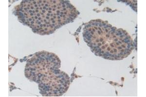 IHC-P analysis of Rat Testis Tissue, with DAB staining. (PLG antibody  (AA 191-433))