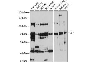 Western blot analysis of extracts of various cell lines, using ZP1 antibody (ABIN6130973, ABIN6150532, ABIN6150533 and ABIN6214972) at 1:1000 dilution. (ZP1 antibody  (AA 340-610))