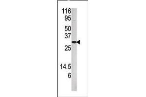 Image no. 1 for anti-Dual Specificity Phosphatase 3 (DUSP3) (N-Term) antibody (ABIN360840) (Dual Specificity Phosphatase 3 (DUSP3) (N-Term) antibody)
