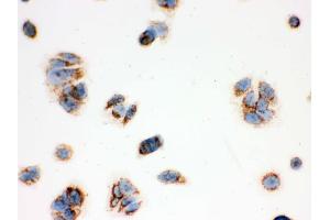 IHC analysis of ERAB using anti-ERAB antibody . (HSD17B10 antibody  (AA 48-261))