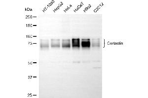Western blotting analysis using cortactin antibody (ABIN7798158).