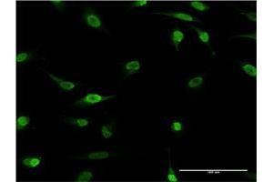 Immunofluorescence of monoclonal antibody to HES2 on HeLa cell. (HES2 antibody  (AA 41-114))
