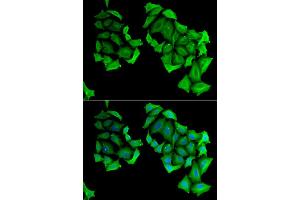 Immunofluorescence analysis of HeLa cell using C4BPB antibody. (C4BPB antibody)