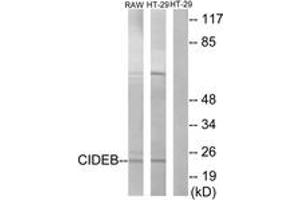 Western blot analysis of extracts from HT-29/RAW264. (CIDEB antibody  (AA 91-140))