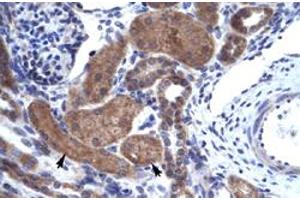 Immunohistochemical staining (Formalin-fixed paraffin-embedded sections) of human kidney with IKZF2 polyclonal antibody  at 4-8 ug/mL working concentration. (IKZF2 antibody  (C-Term))