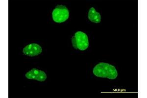 Immunofluorescence of monoclonal antibody to HLF on HeLa cell. (HLF antibody  (AA 1-295))