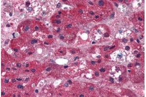 Human Adrenal (formalin-fixed, paraffin-embedded) stained with ARIH1 antibody ABIN337340 at 5 ug/ml followed by biotinylated anti-goat IgG secondary antibody ABIN481715, alkaline phosphatase-streptavidin and chromogen. (ARIH1 antibody  (AA 513-526))