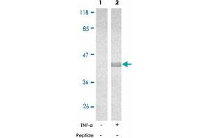 Western blot analysis of extract from 293 cells, untreated or treated with TNF-a (20 ng/mL, 15 min), using NFKBIE (phospho S22) polyclonal antibody . (NFKBIE antibody  (pSer22))