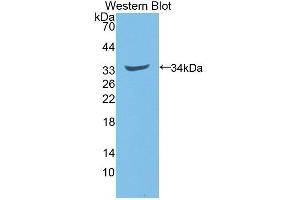 Detection of Recombinant NQO1, Rat using Polyclonal Antibody to NADH Dehydrogenase, Quinone 1 (NQO1) (NQO1 antibody  (AA 2-273))