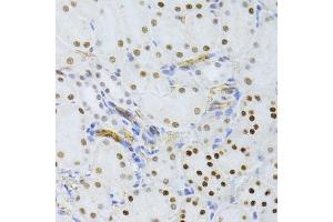 Immunohistochemistry of paraffin-embedded mouse kidney using SNRNP70 antibody. (SNRNP70 antibody  (AA 150-250))