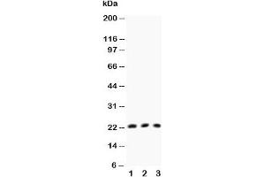 Western blot testing of TNFb antibody and Lane 1:  HeLa;  2: MCF-7;  3: COLO320 (LTA antibody  (AA 45-59))