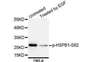 Western Blotting (WB) image for anti-Heat Shock 27kDa Protein 1 (HSPB1) (pSer82) antibody (ABIN3023550) (HSP27 antibody  (pSer82))