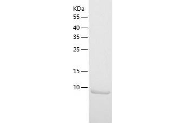 CCL3L1 Protein (AA 24-93) (His tag)