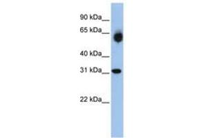 Image no. 1 for anti-Dehydrogenase/reductase (SDR Family) Member 2 (DHRS2) (AA 108-157) antibody (ABIN6740754) (DHRS2 antibody  (AA 108-157))