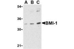Western blot analysis of BMI-1 in K562 cell lysate with AP30158PU-N BMI-1 antibody at (A) 0. (BMI1 antibody  (Intermediate Domain))