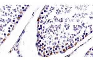 Immunohistochemistry (IHC) image for anti-Histone Deacetylase 1 (HDAC1) (AA 1-482) antibody (ABIN7426493)
