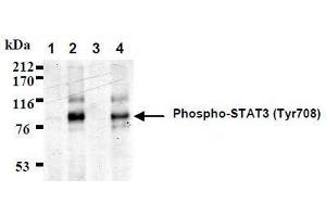 Western Blotting (WB) image for anti-Signal Transducer and Activator of Transcription 3 (Acute-Phase Response Factor) (STAT3) (AA 703-714), (pTyr705), (pTyr708) antibody (ABIN1449165) (STAT3 antibody  (pTyr705, pTyr708))