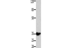 Western Blotting (WB) image for anti-Homeobox A11 (HOXA11) antibody (ABIN2431519)