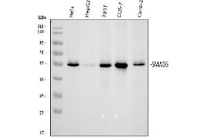 Western blot analysis of SMAD5 using anti-SMAD5 antibody (ABIN7602972).