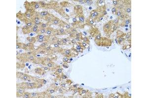 Immunohistochemistry of paraffin-embedded Human liver using CCM2 Polyclonal Antibody at dilution of 1:100 (40x lens). (CCM2 antibody)