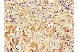 Immunohistochemistry of paraffin-embedded human lung tissue using ABIN7162869 at dilution of 1:100 (Peptidyl-tRNA Hydrolase ICT1, Mitochondrial (AA 30-206) antibody)