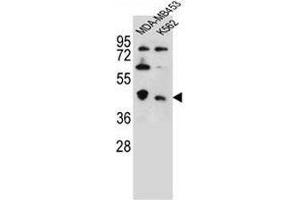 CTBP1 Antibody (C-term) western blot analysis in MDA-MB453,K562 cell line lysates (35µg/lane).