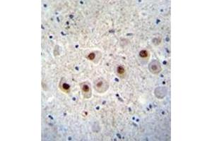 Formalin fixed and paraffin embedded human brain tissue stained with RBM14 Antibody (C-term) followed by peroxidase conjugation of the secondary antibody and DAB staining.