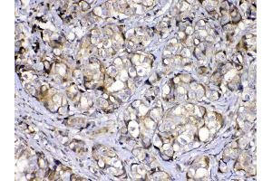 IHC analysis of COPE using anti-COPE antibody . (COPE antibody  (AA 80-308))