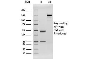 SDS-PAGE Analysis Purified CD79b Recombinant Mouse Monoclonal Antibody (rIGB/1842). (Recombinant CD79b antibody  (AA 29-159))