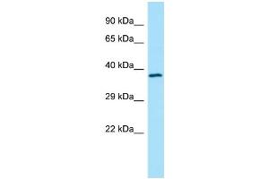 WB Suggested Anti-TMOD4 Antibody Titration: 1. (Tropomodulin 4 antibody  (Middle Region))