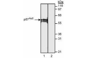 Western blot analysis of p57[Kip2]. (CDKN1C antibody)