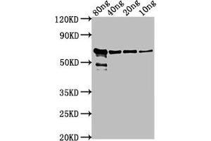 Western Blot Positive WB detected in Recombinant protein All lanes: VP2 antibody at 1:2000 Secondary Goat polyclonal to rabbit IgG at 1/50000 dilution Predicted band size: 62 kDa Observed band size: 62 kDa (VP2 (AA 1-216) antibody)
