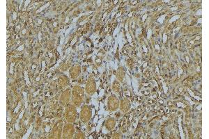ABIN6273009 at 1/100 staining Mouse kidney tissue by IHC-P. (MYH4 antibody  (Internal Region))