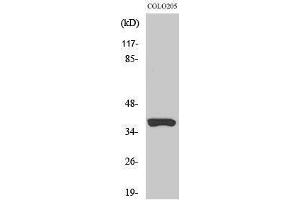 Western Blotting (WB) image for anti-Olfactory Receptor, Family 52, Subfamily B, Member 2 (OR52B2) (Internal Region) antibody (ABIN6281850) (OR52B2 antibody  (Internal Region))