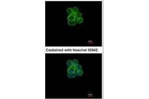 ICC/IF Image Immunofluorescence analysis of methanol-fixed A431, using SGLT1, antibody at 1:500 dilution. (SLC5A1 antibody  (Center))