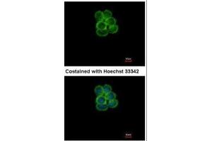 ICC/IF Image Immunofluorescence analysis of methanol-fixed A431, using SGLT1, antibody at 1:500 dilution. (SLC5A1 antibody  (Center))