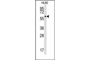 Image no. 1 for anti-Src-Related Kinase Lacking C-Terminal Regulatory Tyrosine and N-Terminal Myristylation Sites (SRMS) (N-Term) antibody (ABIN359993) (SRMS antibody  (N-Term))