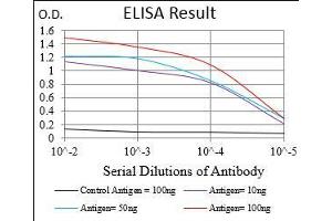 Black line: Control Antigen (100 ng), Purple line: Antigen(10 ng), Blue line: Antigen (50 ng), Red line: Antigen (100 ng), (CAMKII gamma antibody  (AA 322-481))