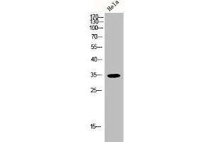 Western Blot analysis of HELA cells using p35 Polyclonal Antibody (CDK5R1 antibody  (N-Term))