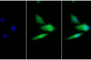 Detection of GLa in Human Hela cell using Polyclonal Antibody to Galactosidase Alpha (GLa) (GLA antibody  (AA 147-371))