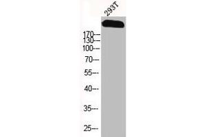 Western Blot analysis of 293T cells using Na+ CP type IXα Polyclonal Antibody (SCN9A antibody  (Internal Region))